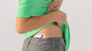 Dexcom G6 Övre delen av skinkan