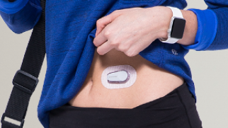 Dexcom G6 Magen