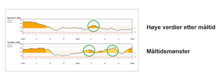 Dexcom-G6-Clarity-daglig-rapport_NO