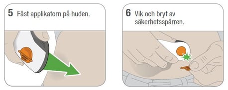 Sätta sensor 5-6