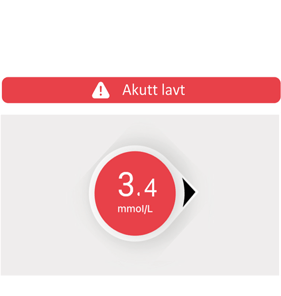 dexcom-larm-akut-lagt-no