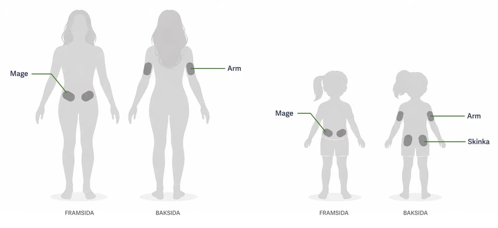 Nordic-infucare-dexcom-placement2